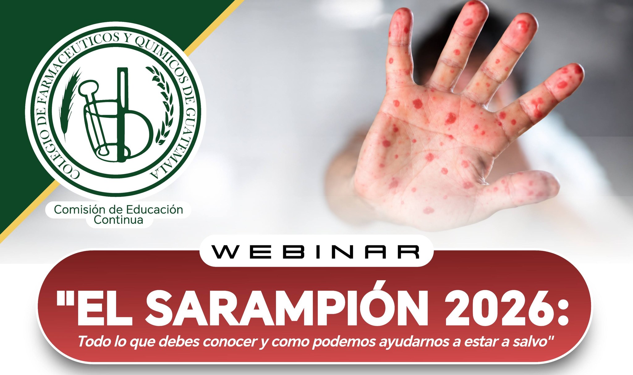 COMISIÓN DE EDUCACIÓN CONTINUA ORGANIZA WEBINAR SOBRE SARAMPIÓN EN GUATEMALA